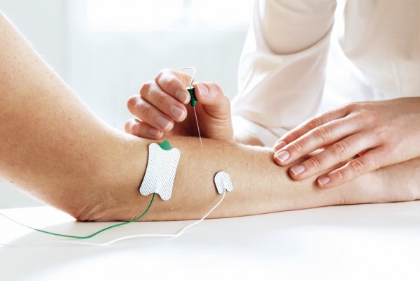 Klebeelektrode Ag/AgCI