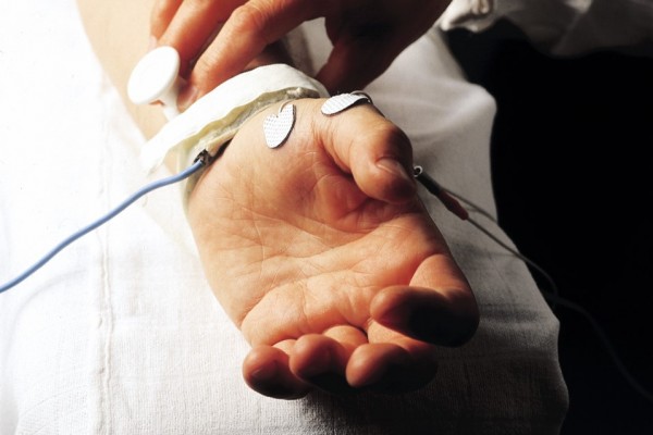 Klebeelektrode Ag/AgCI